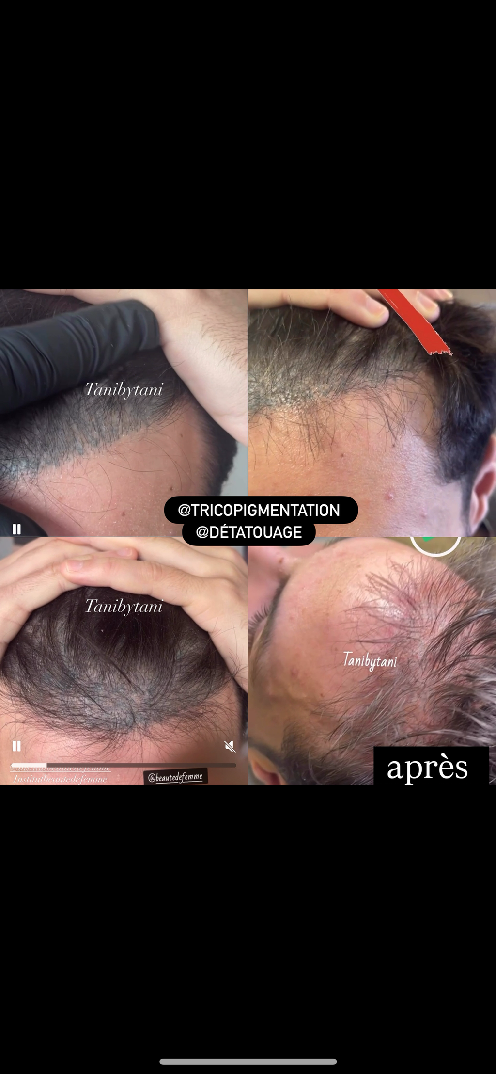 Détatoo by Tani - Le KIT complet !